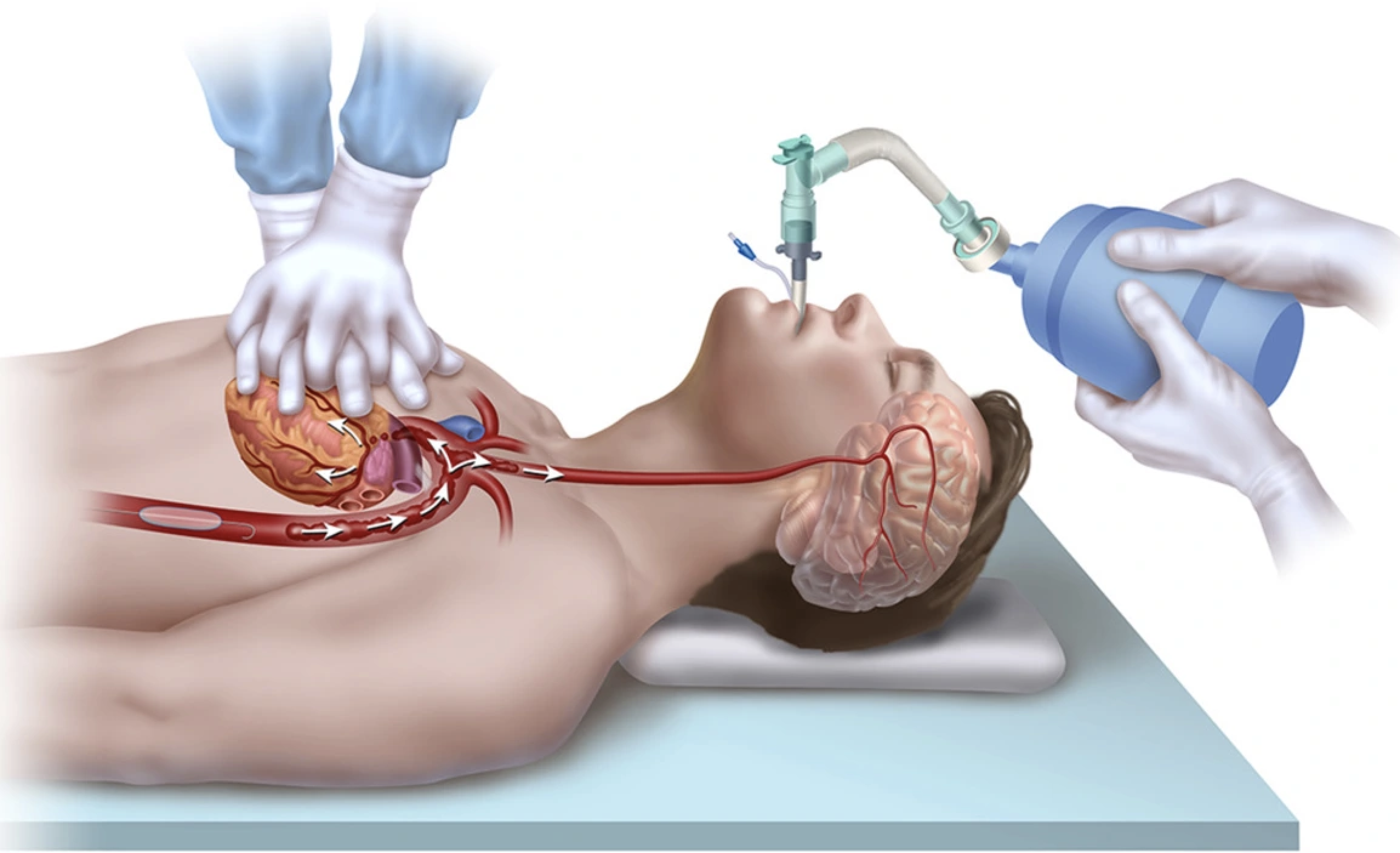 ACLS